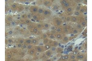 Detection of IL1R1 in Human Liver Tissue using Polyclonal Antibody to Interleukin 1 Receptor Type I (IL1R1)