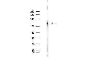 Western blot analysis of lysates from Rat brain, using PKC alpha Antibody at 1/1000 dilution.
