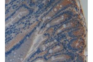 Detection of PAI1 in Rat Rectum Tissue using Polyclonal Antibody to Plasminogen Activator Inhibitor 1 (PAI1)