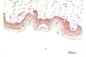 Immunohistochemical analysis of paraffin-embedded Human Skin Tissue using Collagen IV Mouse mAb diluted at 1:2000 (COL4A1 anticorps)