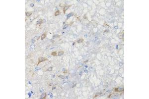 Immunohistochemistry of paraffin-embedded rat brain using CHIC2 antibody (ABIN5974773) at dilution of 1/100 (40x lens). (CHIC2 anticorps)