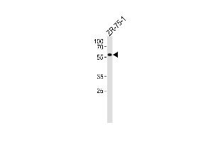 P2R2A Antibody (N-term) (ABIN1881683 and ABIN2843430) western blot analysis in ZR-75-1 cell line lysates (35 μg/lane).