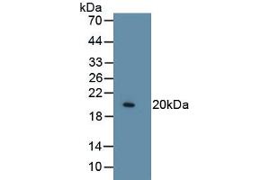 Detection of Recombinant COL8a1, Human using Monoclonal Antibody to Collagen Type VIII Alpha 1 (COL8a1)