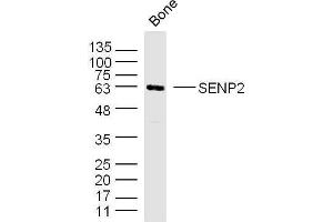 Mouse bone lysates probed with SENP2 Polyclonal Antibody, unconjugated  at 1:300 overnight at 4°C followed by a conjugated secondary antibody for 60 minutes at 37°C. (SENP2 anticorps  (AA 1-100))