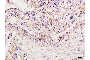 Formalin-fixed and paraffin embedded rat colitis labeled with Anti-IRF-1/MAR1 Polyclonal Antibody, Unconjugated (ABIN686062) at 1:200 followed by conjugation to the secondary antibody and DAB staining. (IRF1 anticorps)