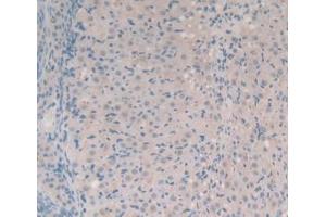 IHC-P analysis of Mouse Ovary Tissue, with DAB staining. (SYN1 anticorps  (AA 113-420))