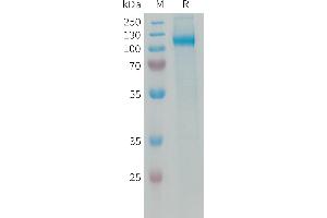 Human Protein, His Tag on SDS-PAGE under reducing condition.