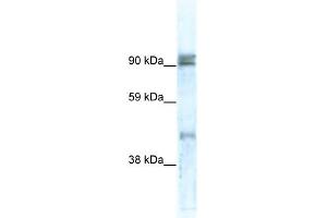 WB Suggested Anti-ZNF227 Antibody Titration:  0. (ZNF227 anticorps  (N-Term))