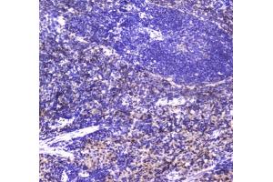 IHC testing of FFPE rat spleen tissue with NKp46 antibody at 1ug/ml. (NCR1 anticorps)
