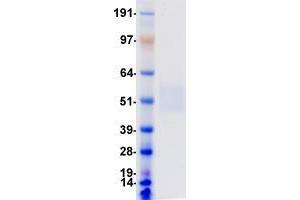 Validation with Western Blot