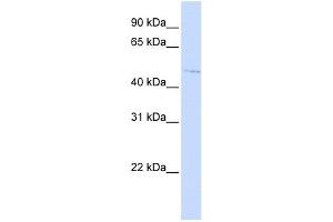 C16ORF58 antibody used at 1 ug/ml to detect target protein. (C16orf58 anticorps  (N-Term))