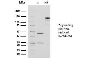 SDS-PAGE Analysis Purified Smooth Muscle Actin MAb (1A4 + ACTA2/791).
