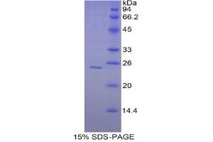 SDS-PAGE analysis of Human Glutathione synthetase Protein. (Glutathione Synthetase Protein (GSS))