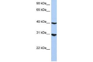 WB Suggested Anti-IRF1 Antibody Titration: 0. (IRF1 anticorps  (N-Term))