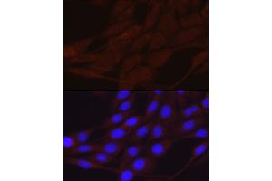 Immunofluorescence analysis of NIH/3T3 cells using SCNN1A Rabbit pAb (ABIN6129465, ABIN6147447, ABIN6147448 and ABIN6221186) at dilution of 1:200 (40x lens).