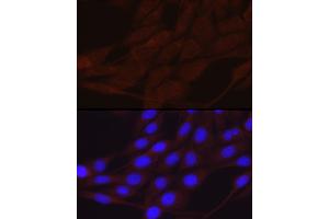 Immunofluorescence analysis of NIH/3T3 cells using SCNN1A Rabbit pAb (ABIN6129465, ABIN6147447, ABIN6147448 and ABIN6221186) at dilution of 1:200 (40x lens). (SCNN1A anticorps  (AA 105-225))