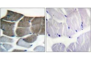 Immunohistochemistry analysis of paraffin-embedded human skeletal muscle tissue, using ACC1 (Ab-80) Antibody. (Acetyl-CoA Carboxylase alpha anticorps  (AA 46-95))