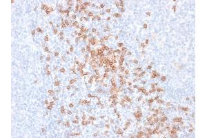 Formalin-fixed, paraffin-embedded human Tonsil stained with CD8 Mouse Recombinant Monoclonal Antibody (rC8/468).