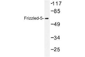 Image no. 1 for anti-Frizzled Family Receptor 5 (FZD5) antibody (ABIN317751)