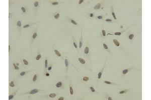 Immunocytochemistry analysis of Hela cells using ABIN7139668 at dilution of 1:100