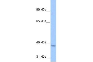 WB Suggested Anti-NSUN3 Antibody Titration:  0. (NSUN3 anticorps  (C-Term))