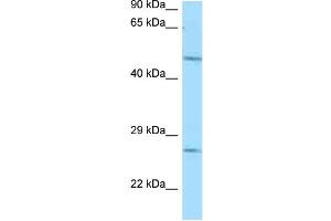 WB Suggested Anti-Entpd1 Antibody Titration: 1. (CD39 anticorps  (N-Term))