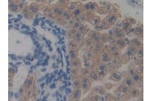 Detection of TRAF2 in Mouse Liver Tissue using Polyclonal Antibody to TNF Receptor Associated Factor 2 (TRAF2)