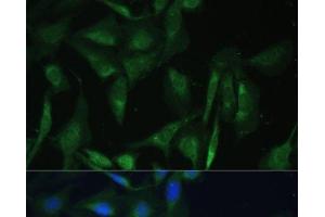 Immunofluorescence analysis of U-2 OS cells using CAMLG Polyclonal Antibody at dilution of 1:100 (40x lens).
