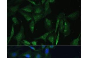Immunofluorescence analysis of U-2 OS cells using CAMLG Polyclonal Antibody at dilution of 1:100 (40x lens). (CAMLG anticorps)