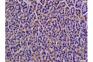 Formalin-fixed and paraffin embedded rat stomach labeled with Anti-MCT4 Polyclonal Antibody, Unconjugated  at 1:200 followed by conjugation to the secondary antibody and DAB staining.