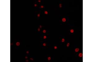 anti-Excision Repair Cross-Complementing Rodent Repair Deficiency, Complementation Group 4 (ERCC4) (C-Term) antibody