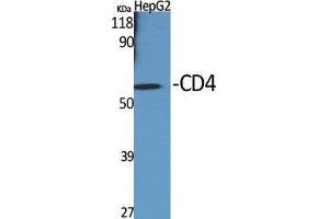 Western Blot (WB) analysis of specific cells using CD4 Polyclonal Antibody. (CD4 anticorps  (Ser213))