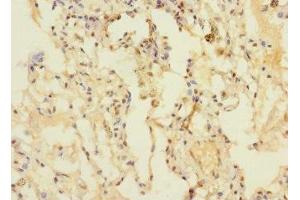 Immunohistochemistry of paraffin-embedded human lung tissue using ABIN7150754 at dilution of 1:100 (DUSP16 anticorps  (AA 416-665))