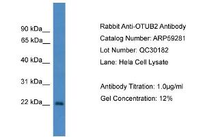 WB Suggested Anti-OTUB2  Antibody Titration: 0. (OTUB2 anticorps  (N-Term))