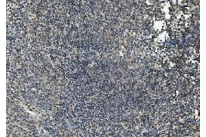 IHC analysis of FLI1 using anti-FLI1 antibody (ABIN7599409). (FLI1 anticorps  (AA 1-452))