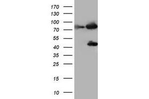 Image no. 1 for anti-Coagulation Factor XIII, A1 Polypeptide (F13A1) antibody (ABIN1498155) (F13A1 anticorps)
