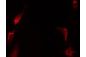 ABIN6267629 staining HeLa by IF/ICC.