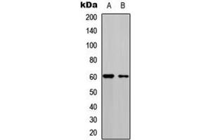 Western blot analysis of CDC25C (pS216) expression in HEK293T (A), A549 (B) whole cell lysates. (CDC25C anticorps  (pSer216))