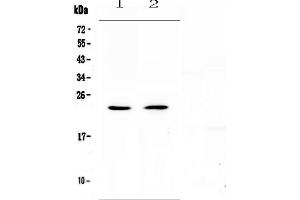 Western blot analysis of FNDC5 using anti-FNDC5 antibody (ABIN5693255).