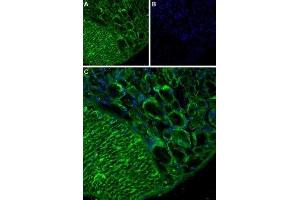 Expression of TRPA1 in rat DRG - Immunohistochemical staining of rat dorsal root ganglion (DRG) using Anti-TRPA1 (extracellular) Antibody (ABIN7043813, ABIN7044000 and ABIN7044001) (1:200).
