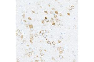 Immunohistochemistry of paraffin-embedded rat brain using Phospho-S6 Ribosomal Protein (RPS6)-S240/244 Rabbit pAb (ABIN6135311, ABIN6136242, ABIN6136243 and ABIN6225563) at dilution of 1:50 (40x lens).