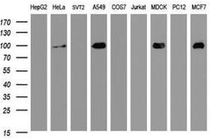 Image no. 1 for anti-Cadherin 1, Type 1, E-Cadherin (Epithelial) (CDH1) antibody (ABIN1497942) (E-cadherin anticorps)