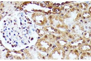 Immunohistochemistry of paraffin-embedded Rat kidney using YAP1 Polyclonal Antibody at dilution of 1:100 (40x lens). (YAP1 anticorps)