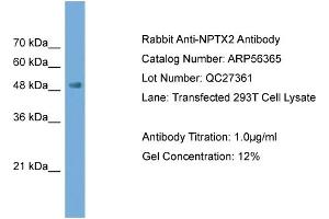 WB Suggested Anti-NPTX2  Antibody Titration: 0. (NPTX2 anticorps  (N-Term))