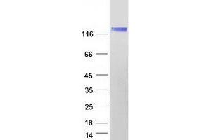 Validation with Western Blot