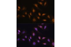 Immunofluorescence analysis of U-2 OS cells using RBM39 antibody (ABIN7270085) at dilution of 1:100.