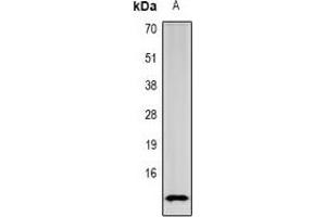 Western blot analysis of SPINK1 expression in mouse intestine (A) whole cell lysates.