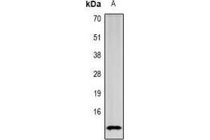 Western blot analysis of SPINK1 expression in mouse intestine (A) whole cell lysates.