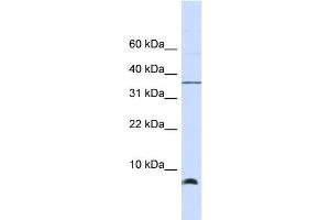 WB Suggested Anti-HSPE1 Antibody Titration: 0. (HSPE1 anticorps  (Middle Region))