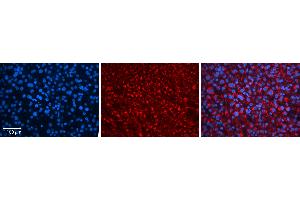 Rabbit Anti-ZNF259 Antibody   Formalin Fixed Paraffin Embedded Tissue: Human Liver Tissue Observed Staining: Cytoplasm in hepatocytes Primary Antibody Concentration: N/A Other Working Concentrations: 1:600 Secondary Antibody: Donkey anti-Rabbit-Cy3 Secondary Antibody Concentration: 1:200 Magnification: 20X Exposure Time: 0.